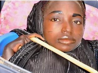 Φωτογραφία για Νιγηρία: Δείτε την 19χρονη που ζει σε μία πλαστική λεκάνη  - Πάσχει από άγνωστη ασθένεια [photos+video]