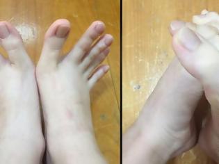 Φωτογραφία για Τα δάχτυλα των ποδιών αυτής της γυναίκας έχουν μπερδέψει και τρελάνει το διαδίκτυο [photos]