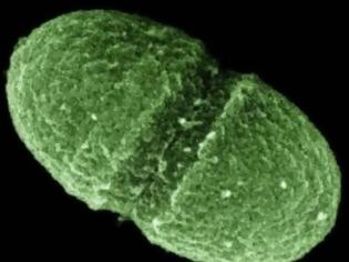 Φωτογραφία για Enterococcus faecalis: Το μαγγάνιο παίζει σημαντικό ρόλο στη βακτηριακή μόλυνση