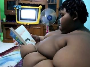 Φωτογραφία για Το παχύτερο αγόρι στον κόσμο κατάφερε να χάσει 30 κιλά