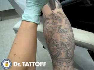 Φωτογραφία για Δείτε πως αφαιρείται το τατουάζ με laser [video]