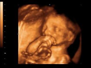 Φωτογραφία για Δείτε το πρώτο υπερηχογράφημα εμβρύου σε 3D