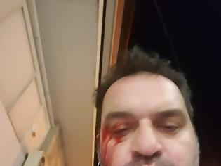 Φωτογραφία για Επίθεση σε γνωστό δικηγόρο με χτυπήματα στο κεφάλι
