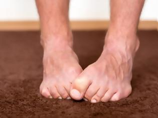 Φωτογραφία για Τι μπορεί να αποκαλύψει το χρώμα των νυχιών στα πόδια μας για την υγεία μας;