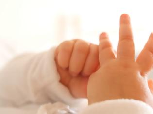 Φωτογραφία για Έρευνα στη Γαλλία για 18 βρέφη που γεννήθηκαν χωρίς χέρια