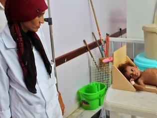 Φωτογραφία για Η πείνα «θερίζει» τα νήπια της Υεμένης: