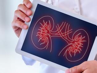 Φωτογραφία για Online τεστ για την υγεία των νεφρών σας εγκεκριμένο από το βρετανικό NHS