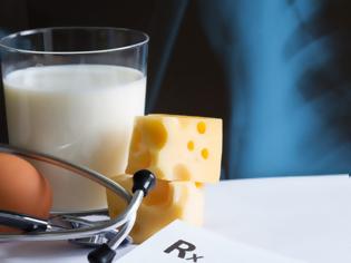 Φωτογραφία για Οστεοπόρωση: Αυτές είναι οι τροφές που ενισχύουν τα οστά