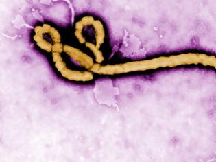 Φωτογραφία για Έφτασε ο Έμπολα στην Ευρώπη;