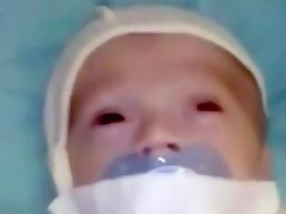 Φωτογραφία για Κόλλησαν με μονωτική ταινία την πιπίλα στο στόμα μωρού σε νοσοκομείο