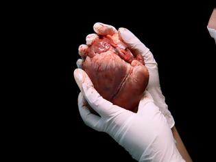 Φωτογραφία για Η πρώτη μεταμόσχευση καρδιάς του 2019 έγινε σε ασθενή που περιμένε 3,5 χρόνια