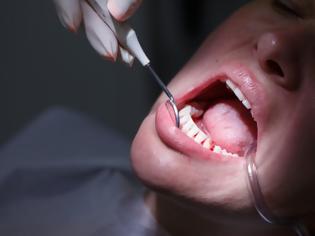 Φωτογραφία για Ποιο σημάδι στα δόντια μπορεί να είναι ένδειξη για διαβήτη τύπου 2;