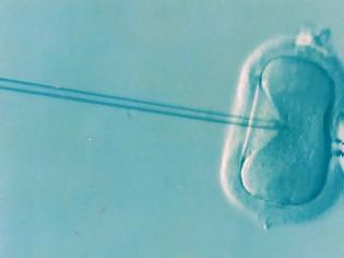 Φωτογραφία για Εξωσωματική γονιμοποίηση: Ελαφρώς αυξημένος ο κίνδυνος επιπλοκών στην κύηση