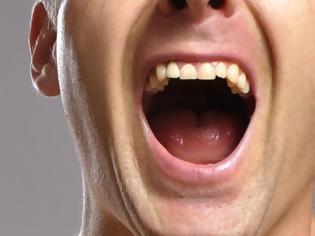 Φωτογραφία για Καρκίνος του στόματος: Ανησυχία προκαλεί στους επιστήμονες η αύξηση των κρουσμάτων