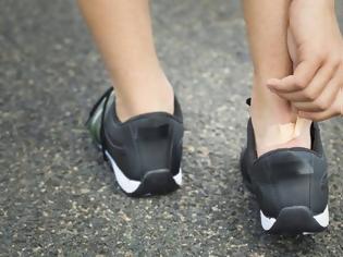 Φωτογραφία για Φουσκάλες στα πόδια: Γιατί δεν κλείνουν οι πληγές;