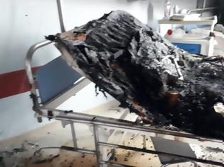 Φωτογραφία για ΚΑΤ: Σοκάρουν οι εικόνες από τον θάλαμο που απανθρακώθηκε ο άτυχος ασθενής