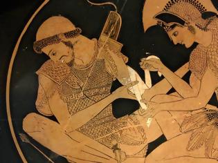 Φωτογραφία για Το καλύτερο δημόσιο σύστημα υγείας είχαν οι Αρχαίοι Έλληνες
