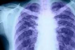 Επιστήμονες δημιούργησαν διαφανή ανθρώπινα όργανα