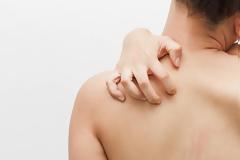 Κνησμός: 10 αιτίες επίμονης φαγούρας στο δέρμα