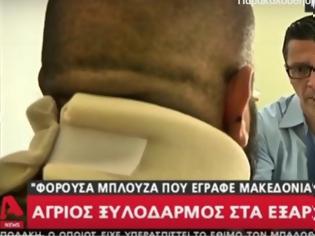 Φωτογραφία για Βίντεο: Με κατάγματα και σχεδόν χωρίς αυτί ο 45χρονος που ξυλοκόπησαν στα Εξάρχεια,γιατί φορούσε μπλούζα «Macedonian Warriors»