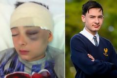 Αν και οι γιατροί του έδιναν μερικούς μήνες ζωής όταν ήταν 10 ετών, σήμερα είναι 15 και έχει ξεπεράσει τον κίνδυνο!