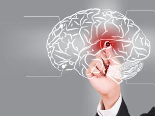 Φωτογραφία για Ανεύρυσμα εγκεφάλου: Ποια συμπτώματα πρέπει να σας οδηγήσουν στο γιατρό;