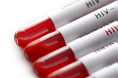 Την εξάλειψη της μάστιγας του AIDS υπόσχονται τα ευρήματα επιστημόνων!