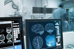 Έρευνα που σοκάρει: Η Ελλάδα έχει τα περισσότερα θανατηφόρα εγκεφαλικά επεισόδια..!!