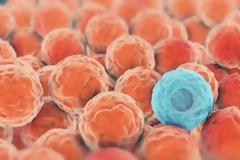 Ο Καρκίνος σε αριθμούς:από όλο τον κόσμο την Ελλάδα