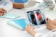 Ελλ. Εταιρεία Ακτινοθεραπευτικής Ογκολογίας: Αγνοεί τα στοιχειώδη ο ΕΟΠΥΥ