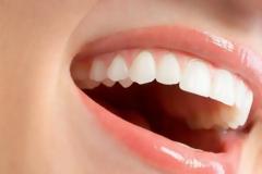 Ποιες τροφές χαρίζουν λευκά δόντια