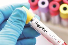 Πώς δεν μεταδίδεται η ηπατίτιδα C; Δείτε 10 περιπτώσεις