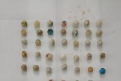 Πάτρα: Κρατούμενοι είχαν καταπιεί εκατοντάδες συσκευασίες ναρκωτικών