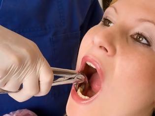 Φωτογραφία για Ξηρό φατνίο. Μία δυσάρεστη μετεγχειρητική οδοντιατρική επιπλοκή