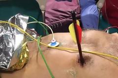 Του καρφώθηκε βέλος στην καρδιά και σώθηκε!