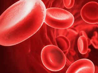 Φωτογραφία για «Χρυσό αίμα»: Η σπανιότατη ομάδα αίματος που έχουν λιγότερα από 50 άτομα παγκοσμίως