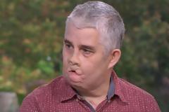 Από μία επίσκεψη στον οδοντίατρο βρέθηκε με ακρωτηριασμένα πόδια και χέρια