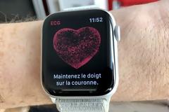 Apple Watch: Επιβεβαιώθηκε από την Apple η ιαθεσιμότητα του ηλεκτροκαρδιογραφήματος (ΗΚΓ) στον Καναδά
