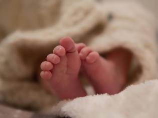 Φωτογραφία για Γεννήθηκε το πιο μικρό μωρό του κόσμου - Ζυγίζει μόλις 245 γραμμάρια, πήρε εξιτήριο μετά από πέντε μήνες