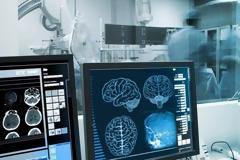 Εγκεφαλικό επεισόδιο: Ο παράγοντας που αυξάνει τον κίνδυνο κατά 30%