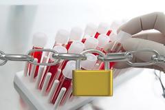 «Λουκέτο» στα διαγνωστικά κέντρα από σήμερα σε όλη τη χώρα