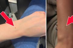 Γιατί όλες οι γυναίκες έχουν μια φακίδα στο ίδιο σημείο του χεριού τους!