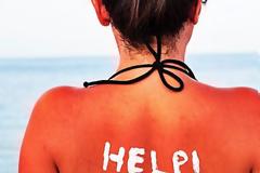 Καήκατε από τον ήλιο; Μη βάλετε γιαούρτι!