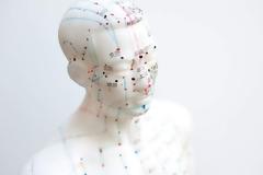 Ο Παγκόσμιος Οργανισμός Υγείας ετοιμάζεται να αναγνωρίσει επίσημα την κινεζική παραδοσιακή ιατρική