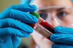 Δωρεάν οι γενετικές εξετάσεις, βιοδείκτες σε ασθενείς με καρκίνο