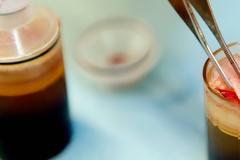 Το επαναστατικό επίθεμα που μπορεί να σώσει τα πόδια των διαβητικών ασθενών