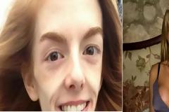 Πώς την έσωσε η… σοκολάτα – Ζύγιζε 30 κιλά