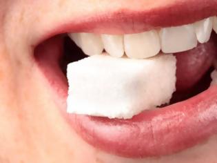 Φωτογραφία για Ζαχαρούχα αναψυκτικά και άλλά ζαχαρούχα προϊόντα ευθύνονται για στοματικές νόσους δισεκατομμυρίων ανθρώπων