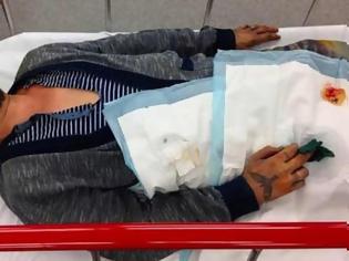Φωτογραφία για Εικόνα σοκ! Πασίγνωστος ηθοποιός στο νοσοκομείο μετά από καβγά με την σύντροφό του!