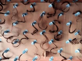 Φωτογραφία για Κοσμοσυρροή στην Τουρκία για μεταμόσχευση μαλλιών!